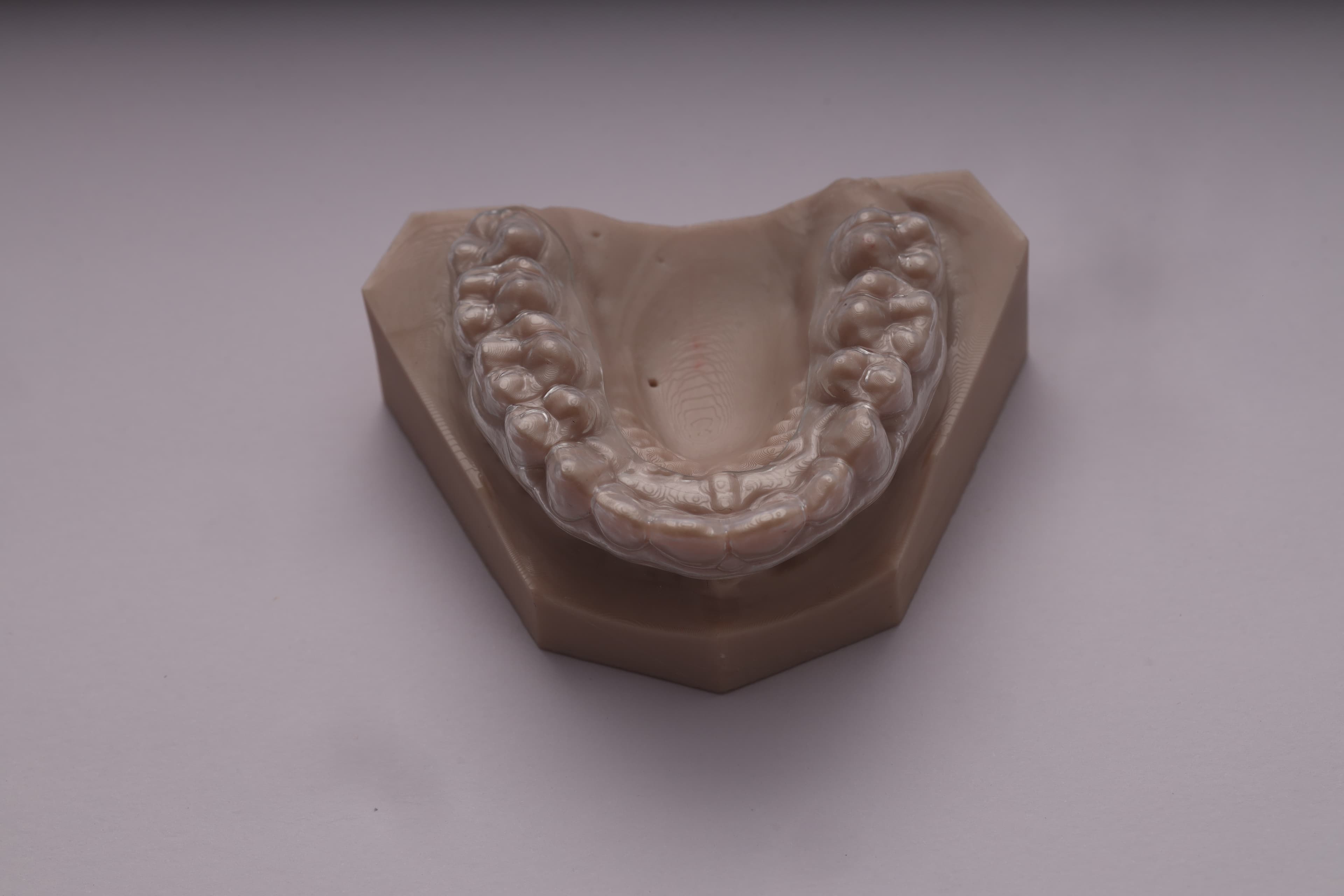 Clear Retainer (Essix Retainer)