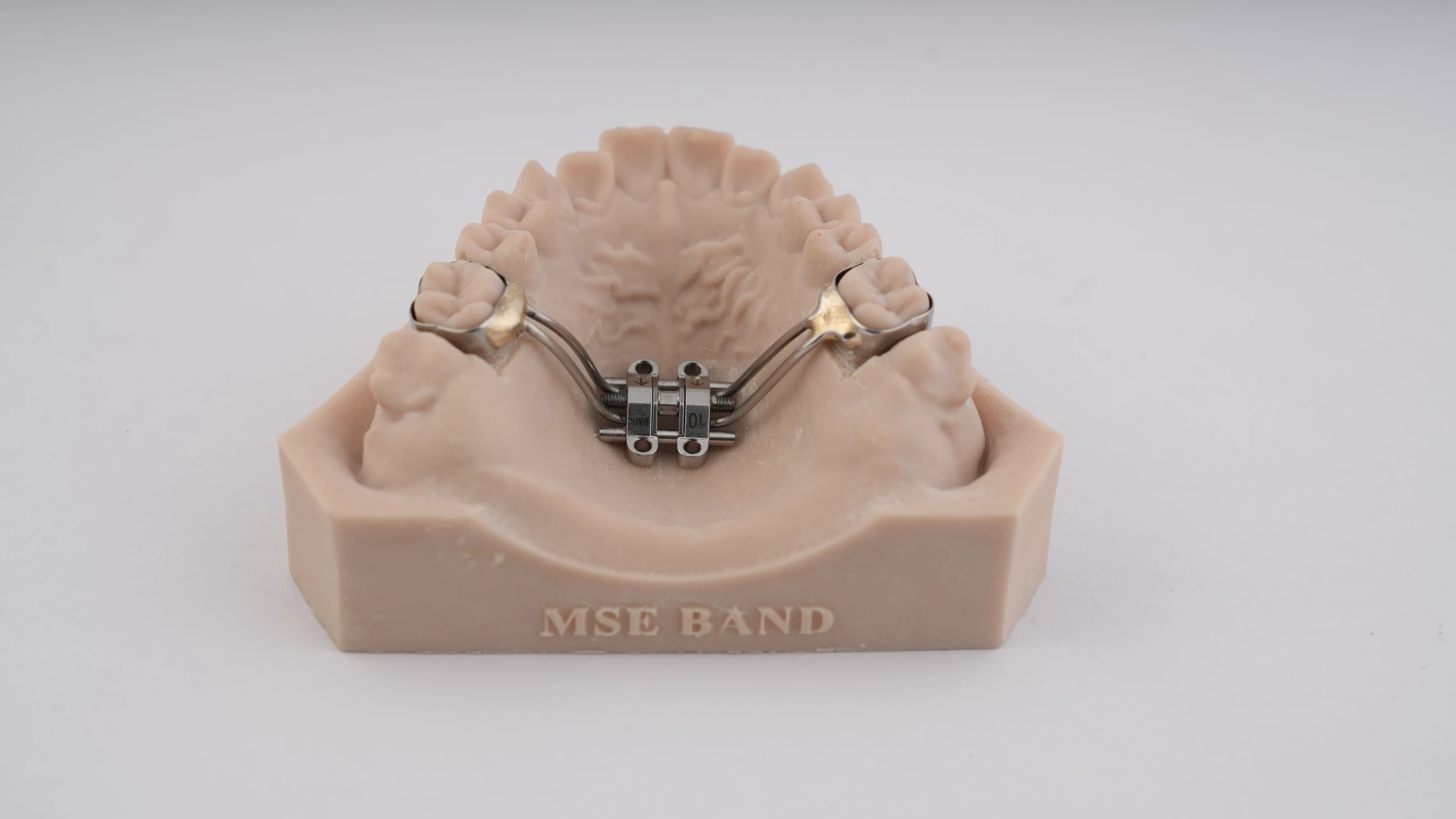 Maxillary Skeletal Expander (MSE – Banded)
