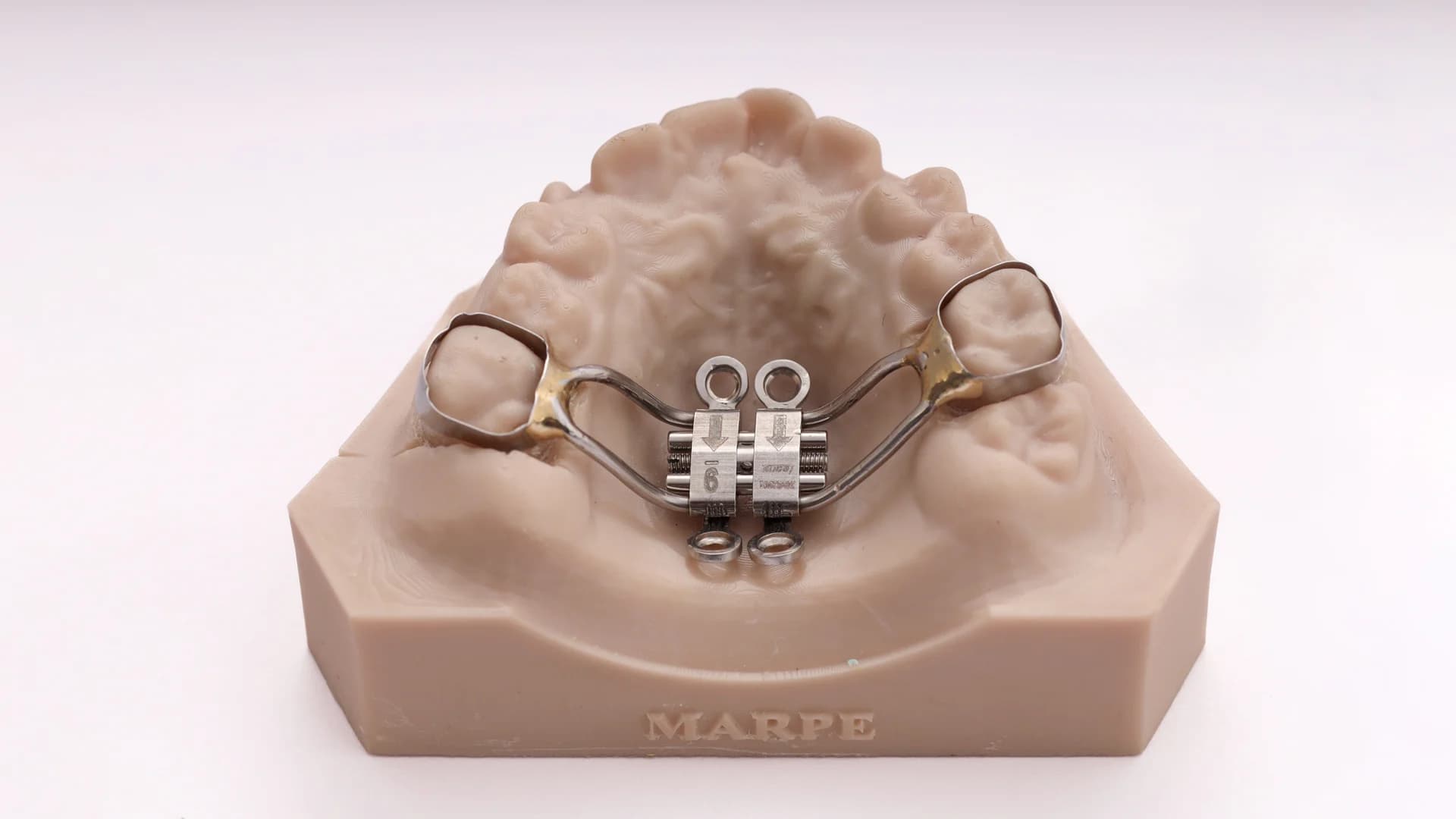 MARPE – Banded