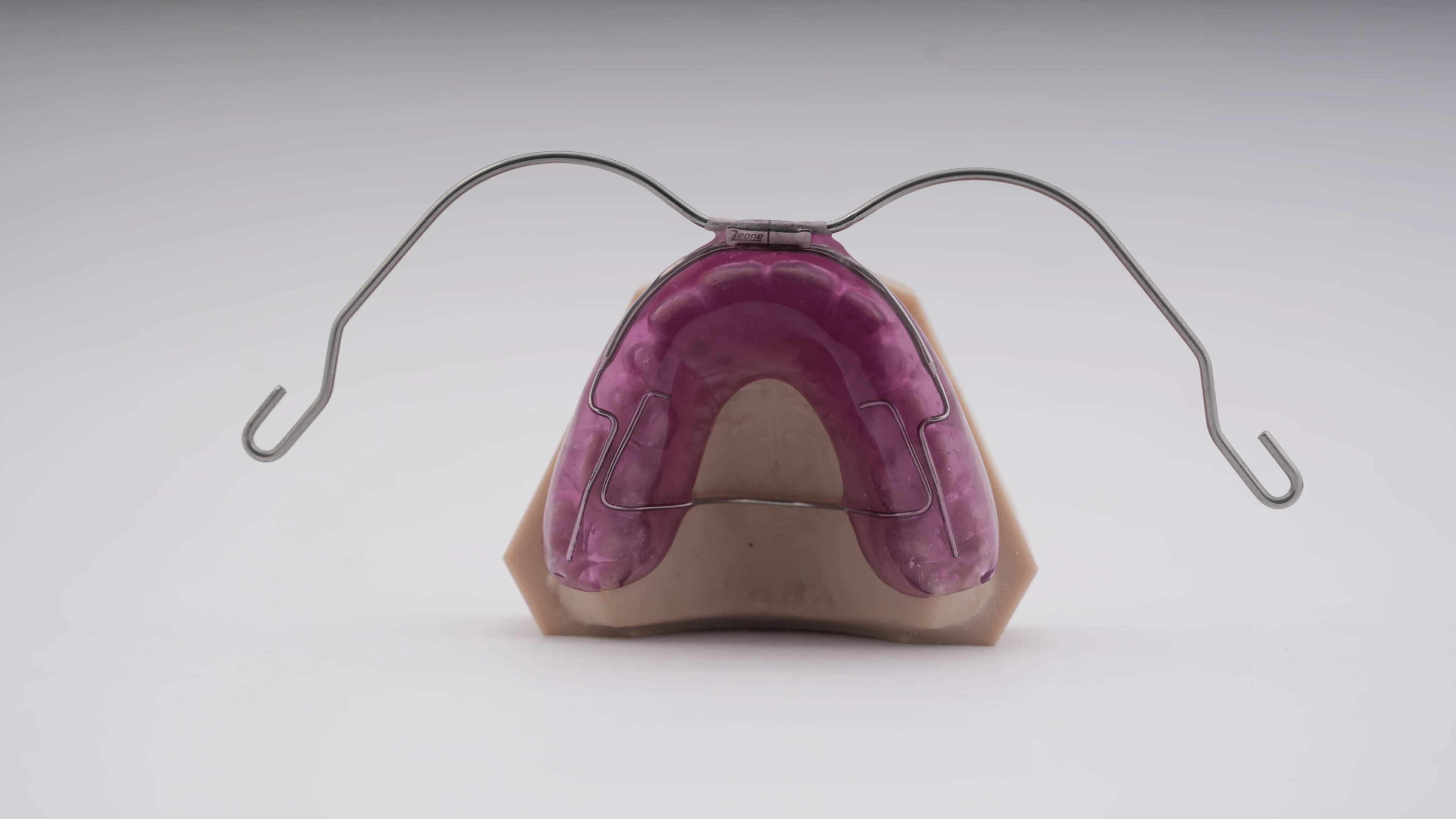 Maxillary Intrusion Splint (with Defined Path of Insertion)