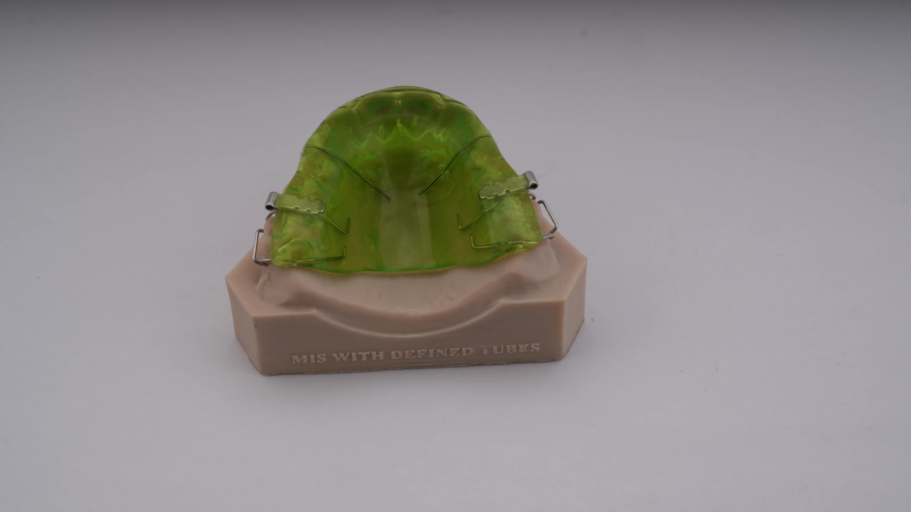 Maxillary Intrusion Splint with Tubes