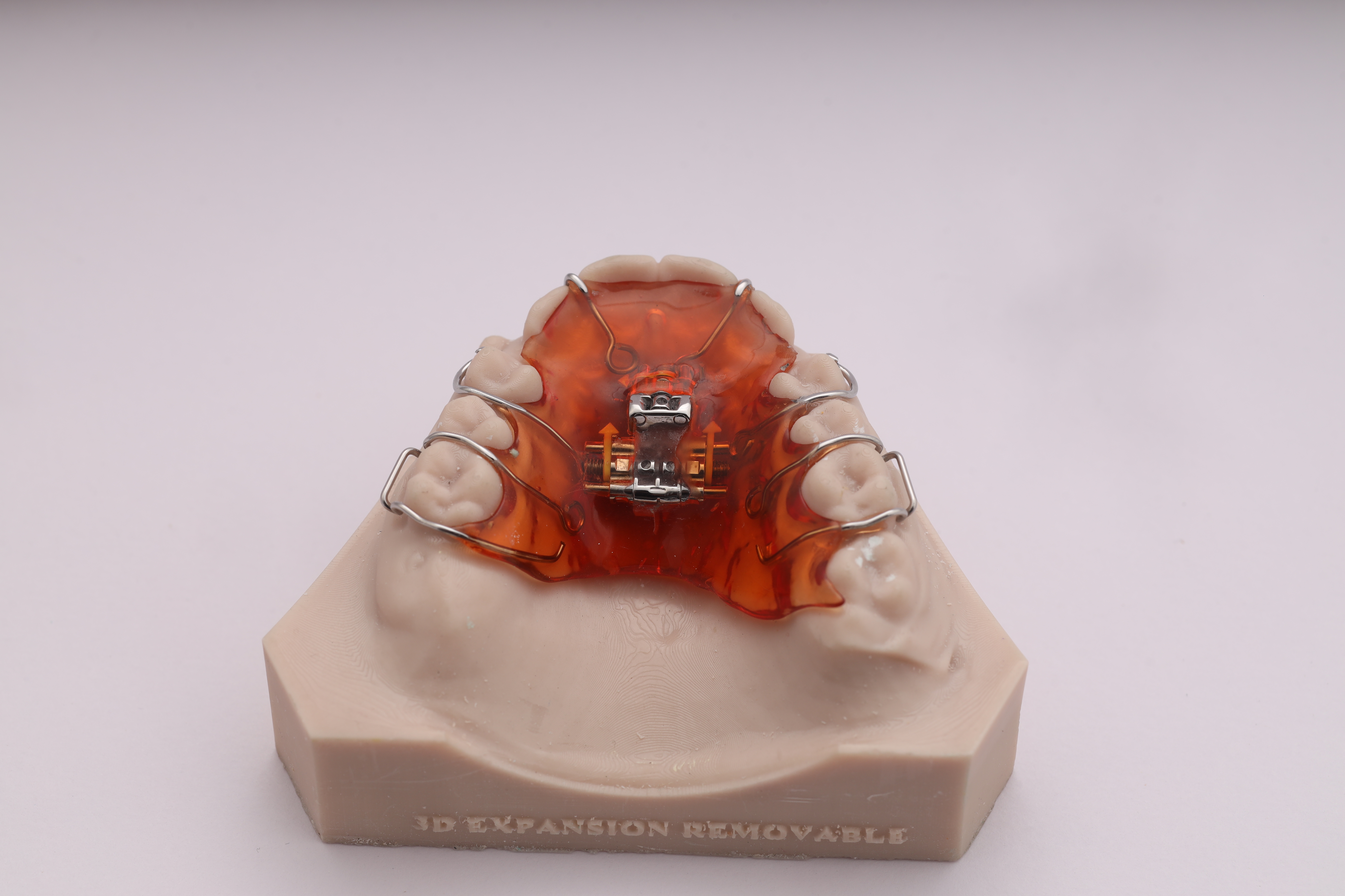 3D Expansion Appliance (with Expansion Screw)