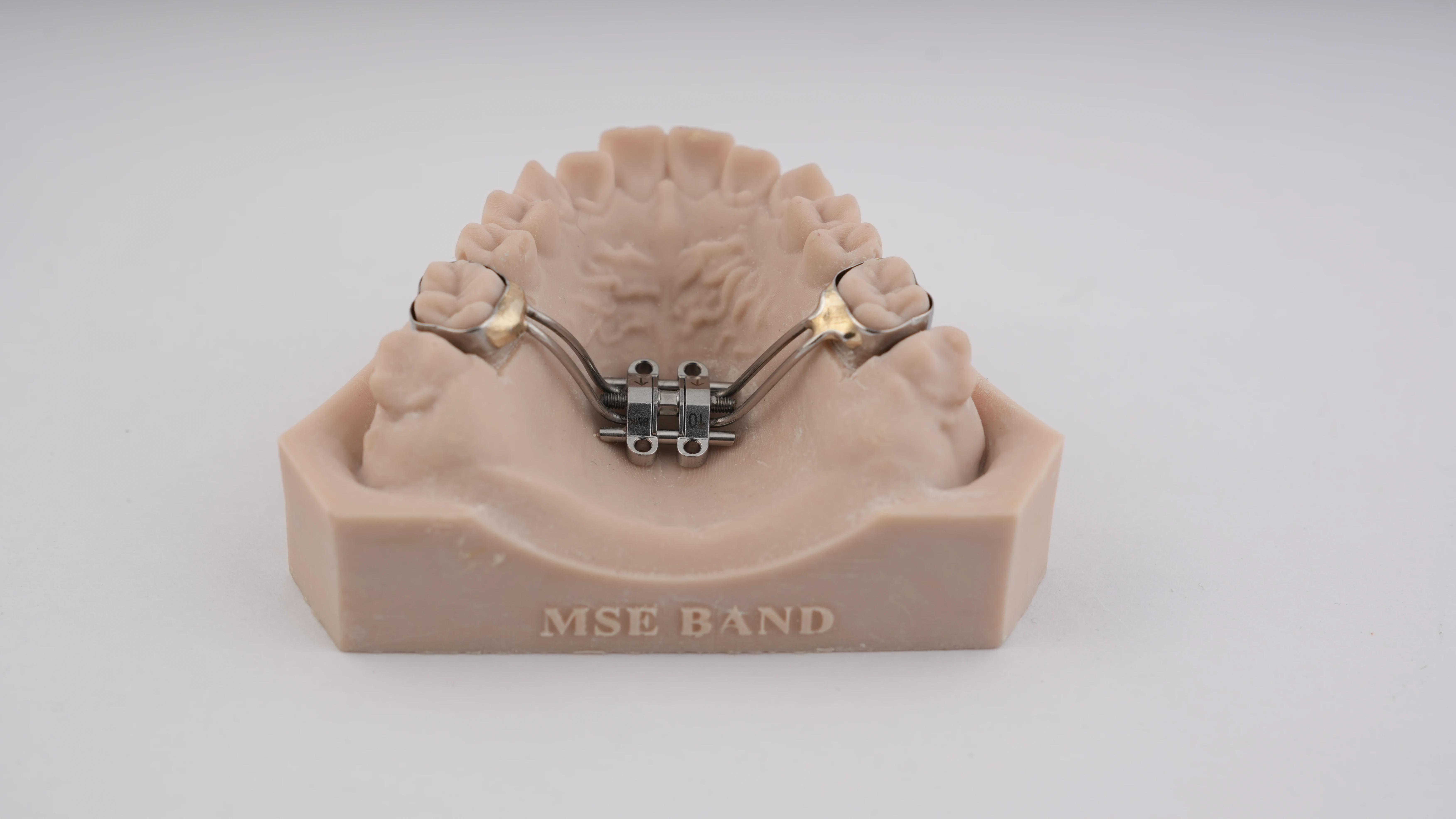 Maxillary Skeletal Expander (MSE – Banded)