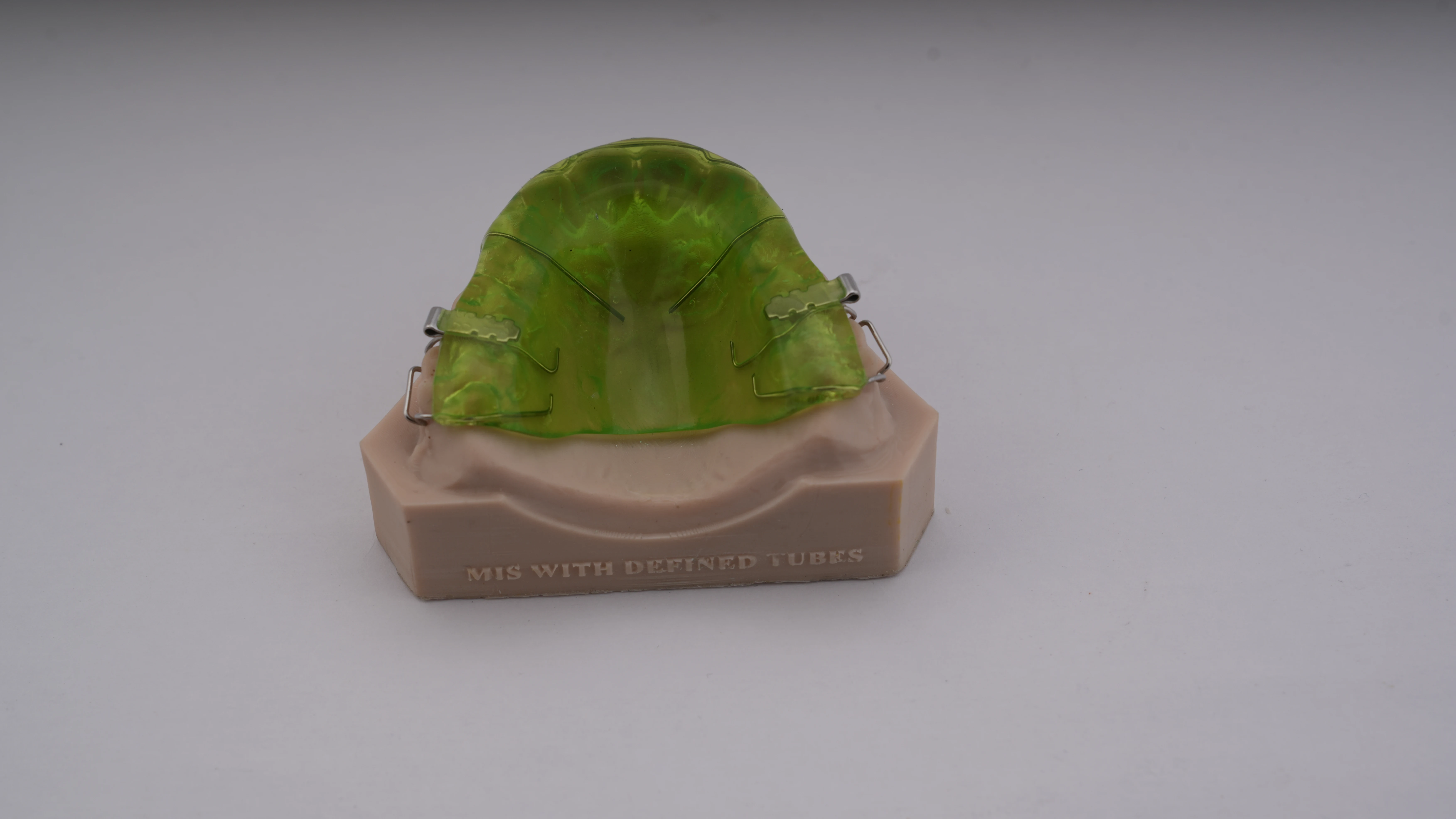 Maxillary Intrusion Splint with Tubes